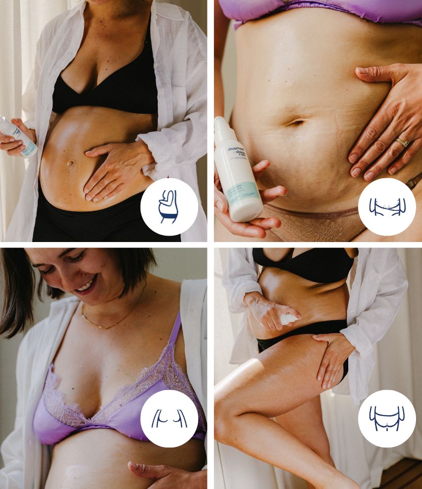 huile vergeture femme